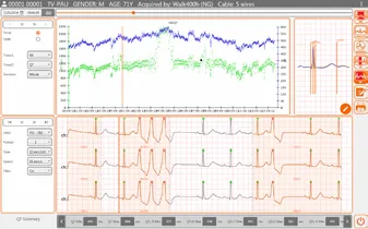 CARDIOLINE CUBEHOLTER Oprogramowanie Do Holterów, Analiza EKG Do 7 Dni